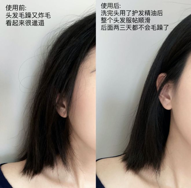 花精油、头皮精华、猪鬃梳、真丝枕套、发圈冰球突破豪华版手机版瀑布发养生好物丨山茶(图9)